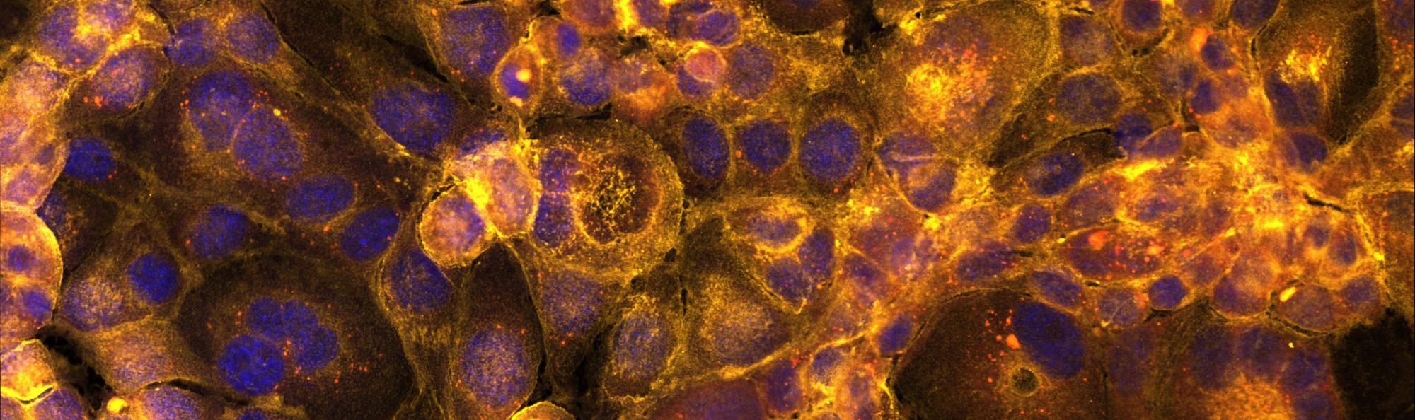 Fluorescent image of hepatocytes by Kaya Wright